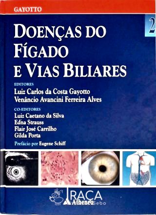 Medicina. Medicina e Saúde. Fígado. Doenças do Fígado. Diabetes Mellitus. Hemocromatose. Doença de W