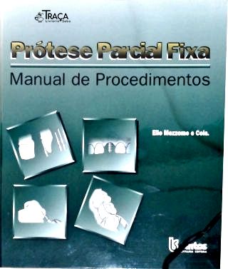 Prótese Parcial Fixa