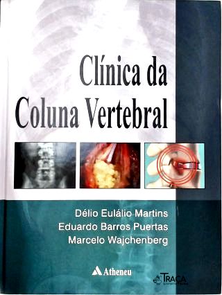 Clínica da Coluna Vertebral