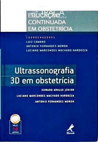 Ultrassonografia 3d em Obstetricia