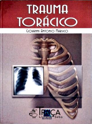 Trauma Torácico