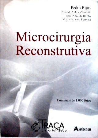 Microcirurgia Reconstrutiva