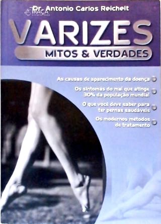 Varizes - Mitos e Verdades