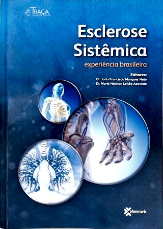 Esclerose Sistêmica: Experiência brasileira