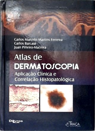 Atlas de Dermatoscopia