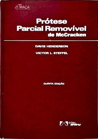 Prótese Parcial Removível de McCracken
