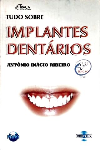 Tudo Sobre Implantes Dentários